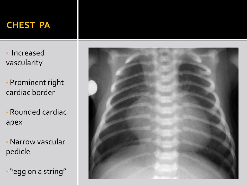 Pediatric Cases Radiology Review Ppt Video Online Download