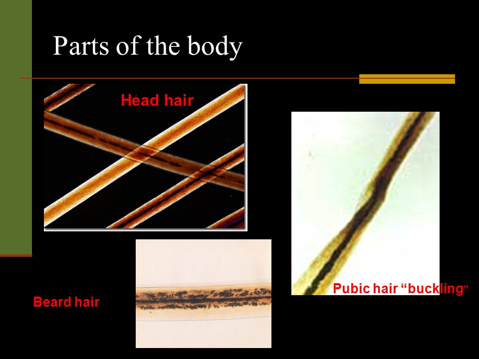 Trace Evidence HAIRS. - ppt video online download