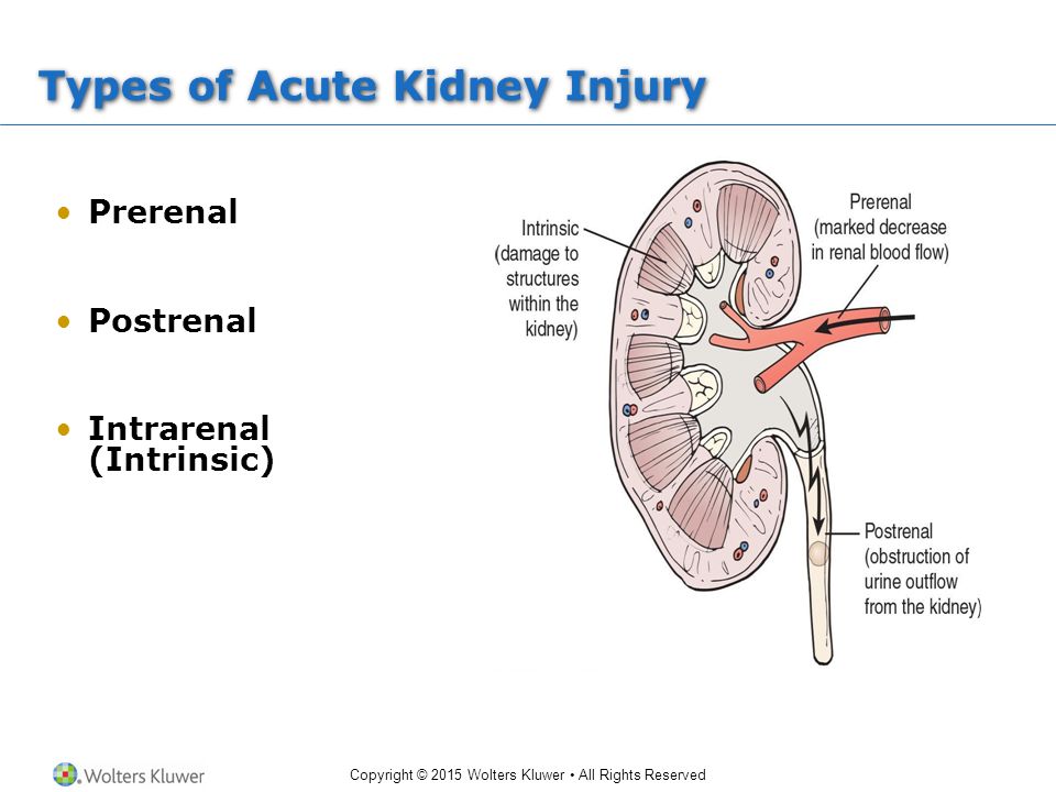 Acute перевод. Acute Kidney injury. Kidney Belt пептиды почек.