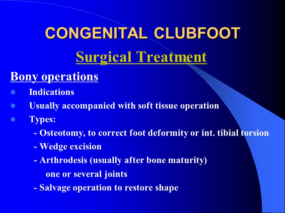 Congenital Clubfoot Congenital Talipes Equino Varus Ppt Video Online Download Congenital Clubfoot Congenital Talipes Equino Varus Ppt Video Online Download