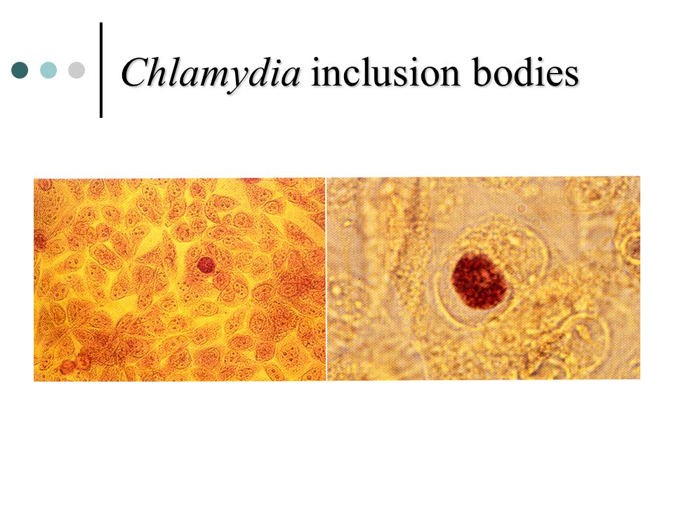 chlamydial inclusion bodies