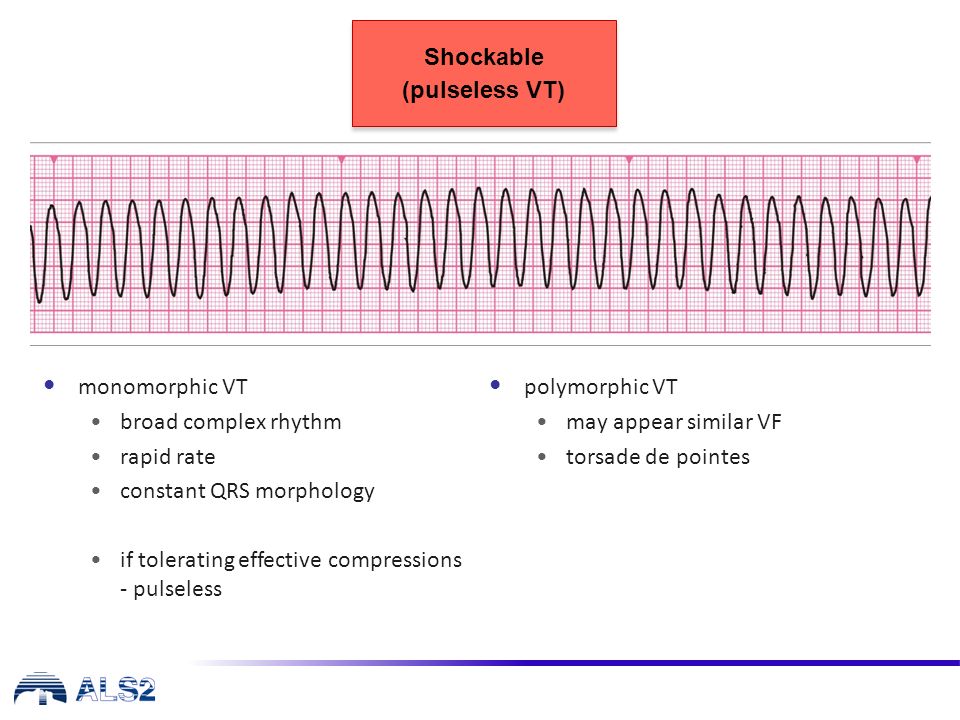 Als Algorithm Ppt Video Online Download