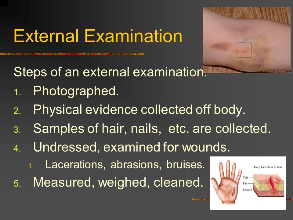 External Examination Steps of an external examination. Photographed.