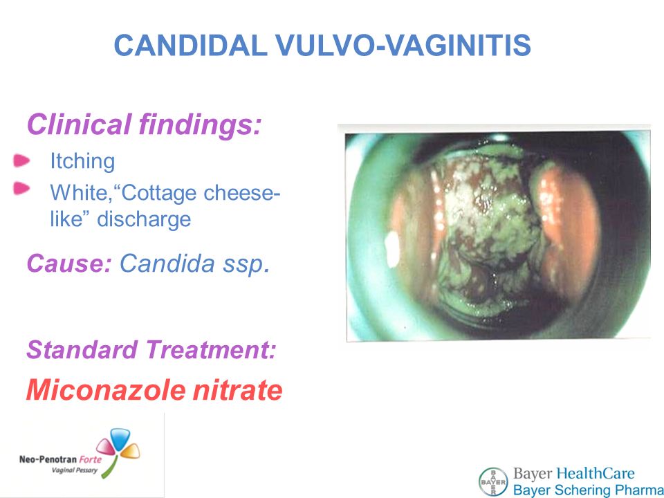 New Standard In Vaginitis Treatment Ppt Video Online Download