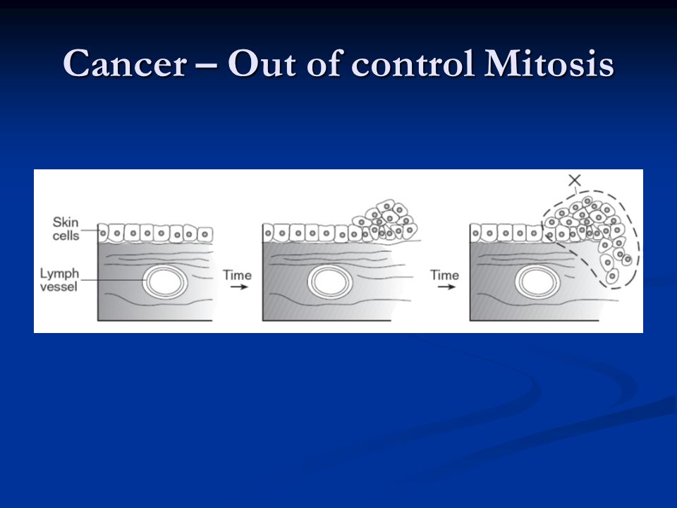 Cancer – Out of control Mitosis
