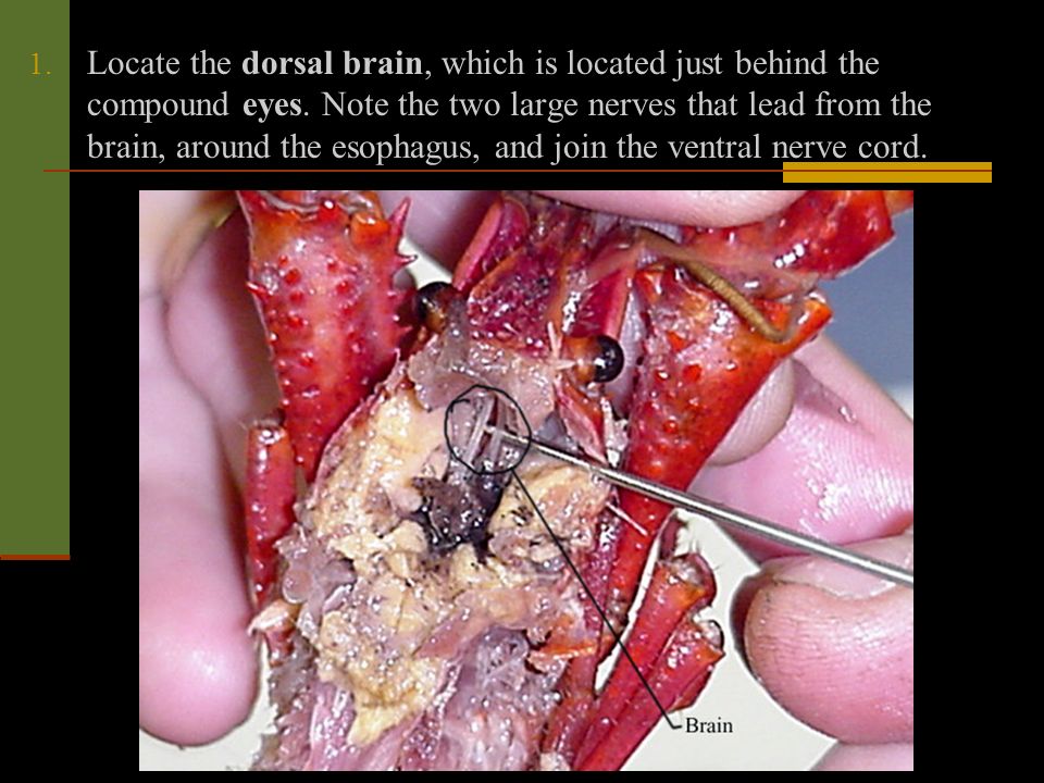 Locate the dorsal brain, which is located just behind the compound eyes.