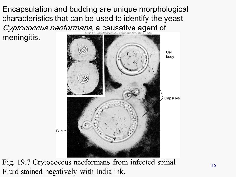 Encapsulation and budding are unique morphological characteristics that can be used to identify the yeast Cyptococcus neoformans, a causative agent of meningitis.