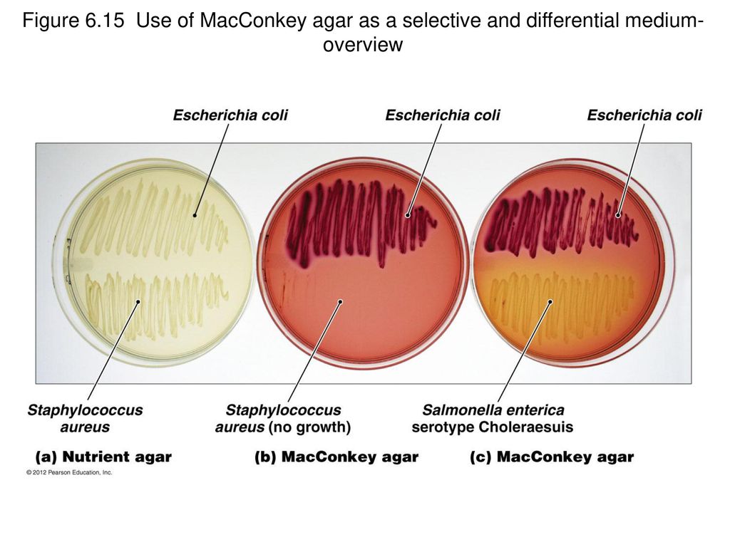 MacConkey Agar Composition, Principle, Uses, Preparation, 44 OFF