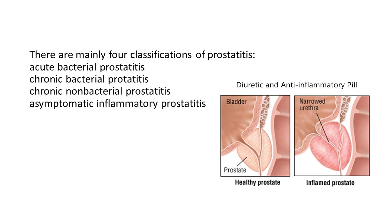 asymptomatic inflammatory prostatitis)