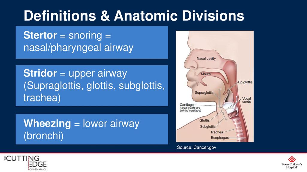 Diagnosing a Noisy Breather: Stridor in infants - ppt download
