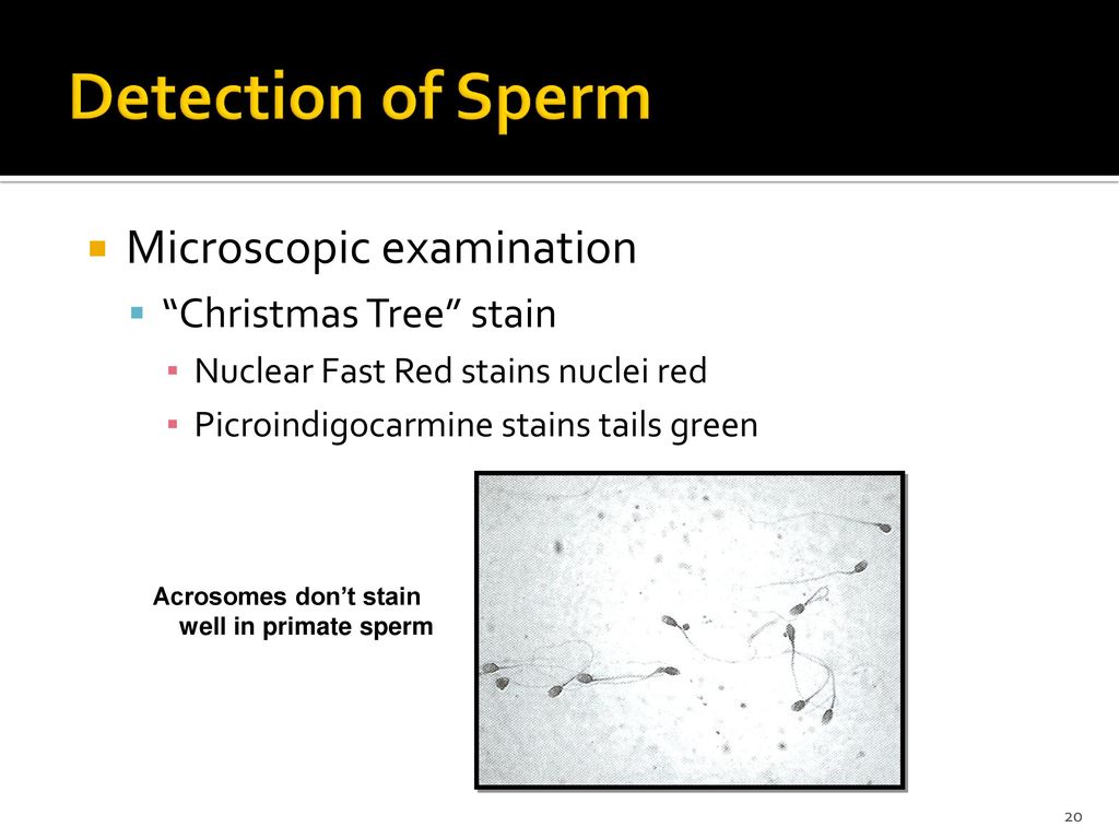 Stains how sperm to detect How To