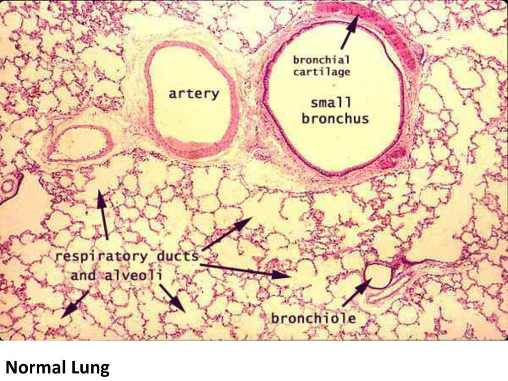 Какая ткань в легких. Ткань легких гистология. Легочная ткань гистология. Respiratory System lung Histology.