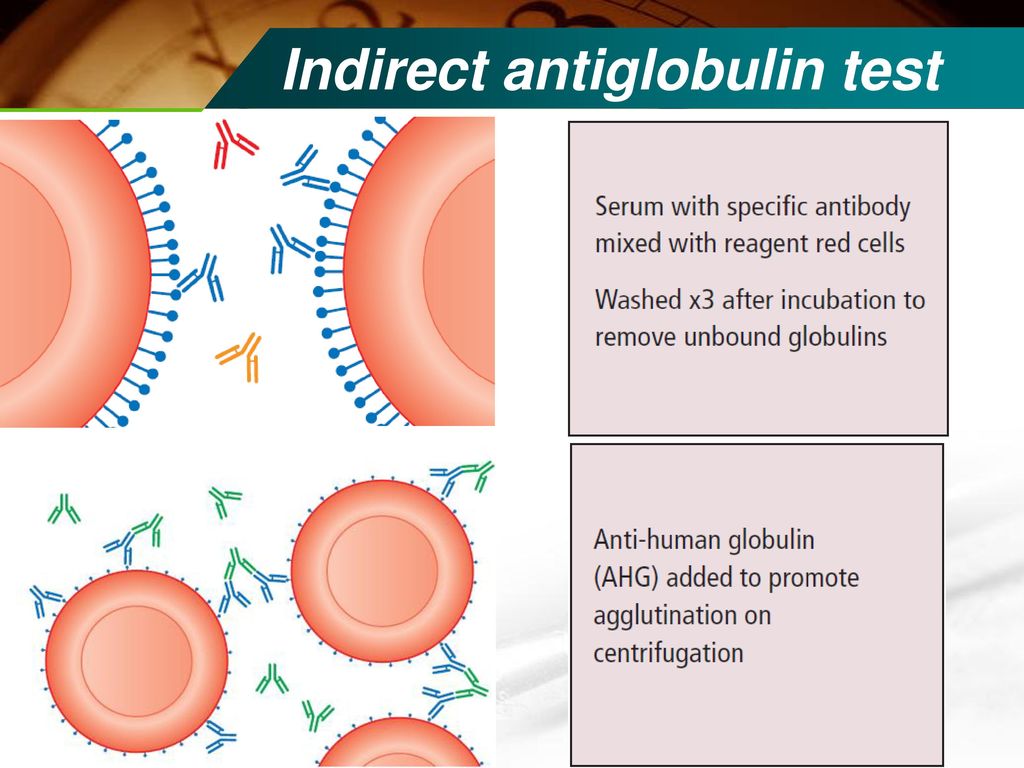Test director. Coombs Test. Indirect procedures. Direct and indirect Testing. Wall Wash Test procedure.