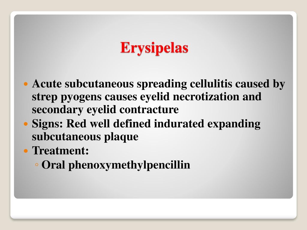 Erysipelas Acute subcutaneous spreading cellulitis caused by strep pyogens causes eyelid necrotization and secondary eyelid contracture.