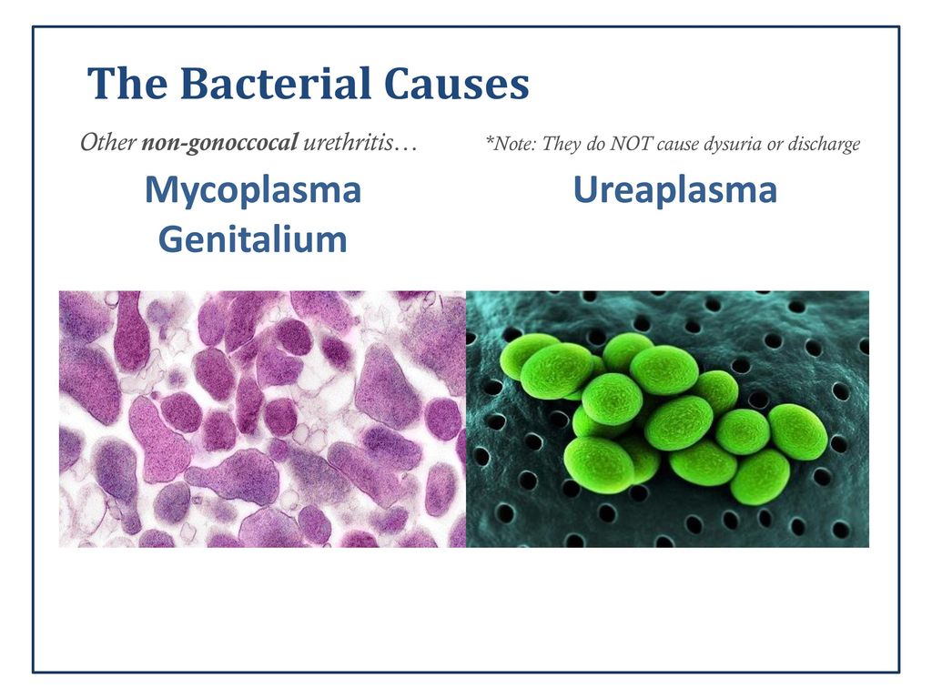 Mycoplasma hominis у мужчин