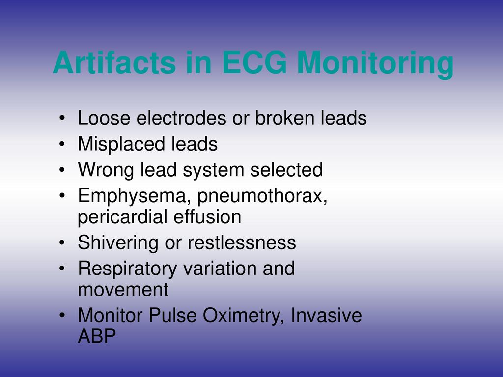 Monitoring In Anesthesia - Ppt Download