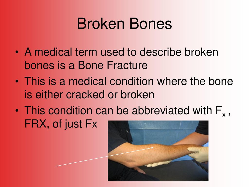 Break a bone. First Aid for broken Ribs. Tail Bone broken. A Minor crack in a Bone is.