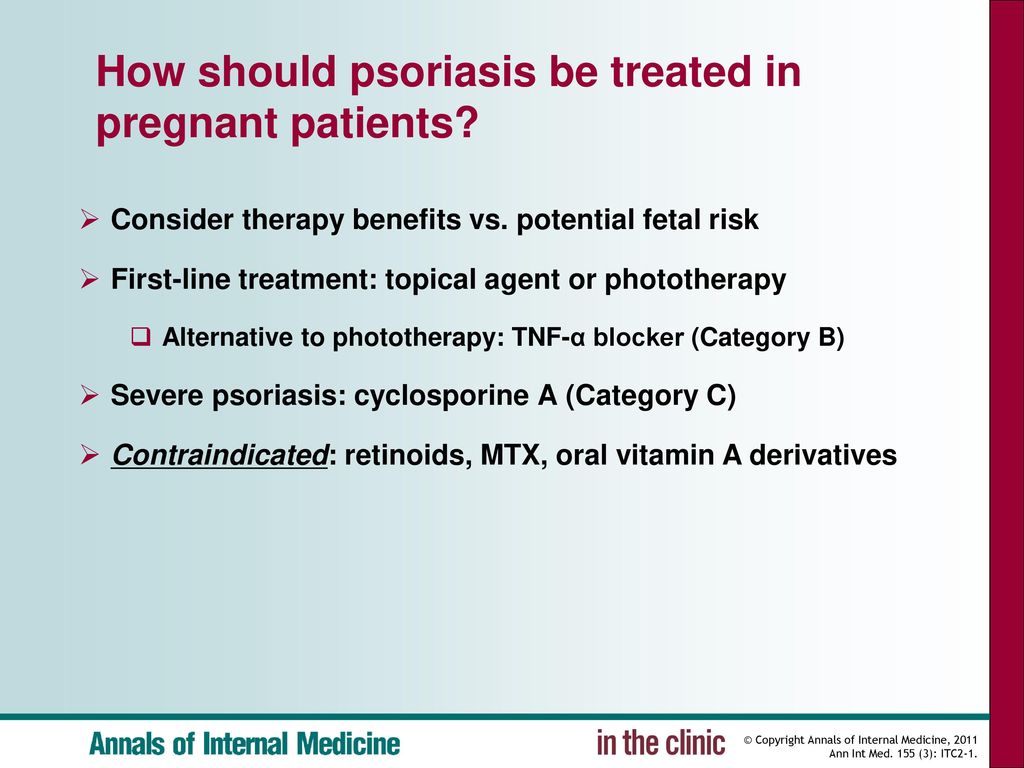 psoriasis in pregnancy treatment