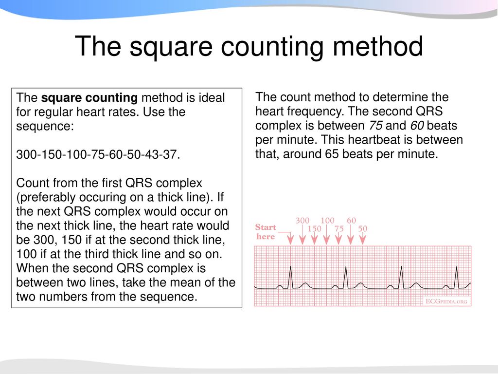When Confronted With An Ecg Always Use A Systematic Approach Following All Steps To Come To The Correct Conclusion In This Course We Use The 7 2 Step Ppt Download When Confronted With An Ecg Always Use A Systematic Approach Following All Steps To Come To The Correct Conclusion In This Course We Use The 7 2 Step Ppt Download