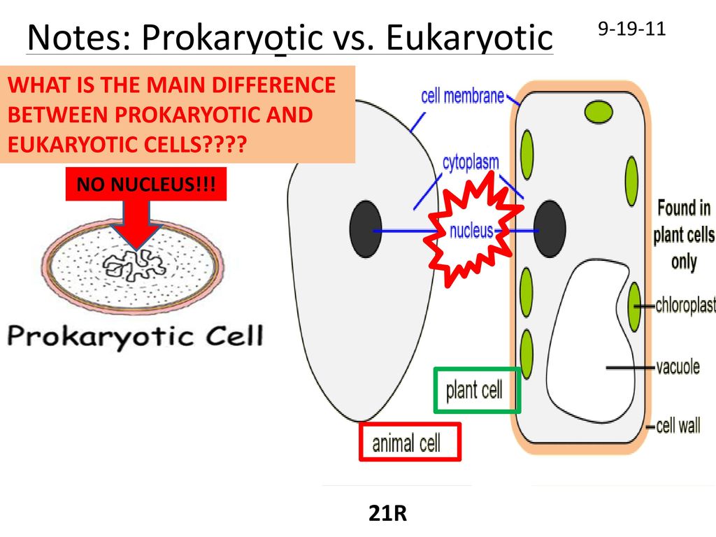 Notes: Prokaryotic vs. Eukaryotic Cells