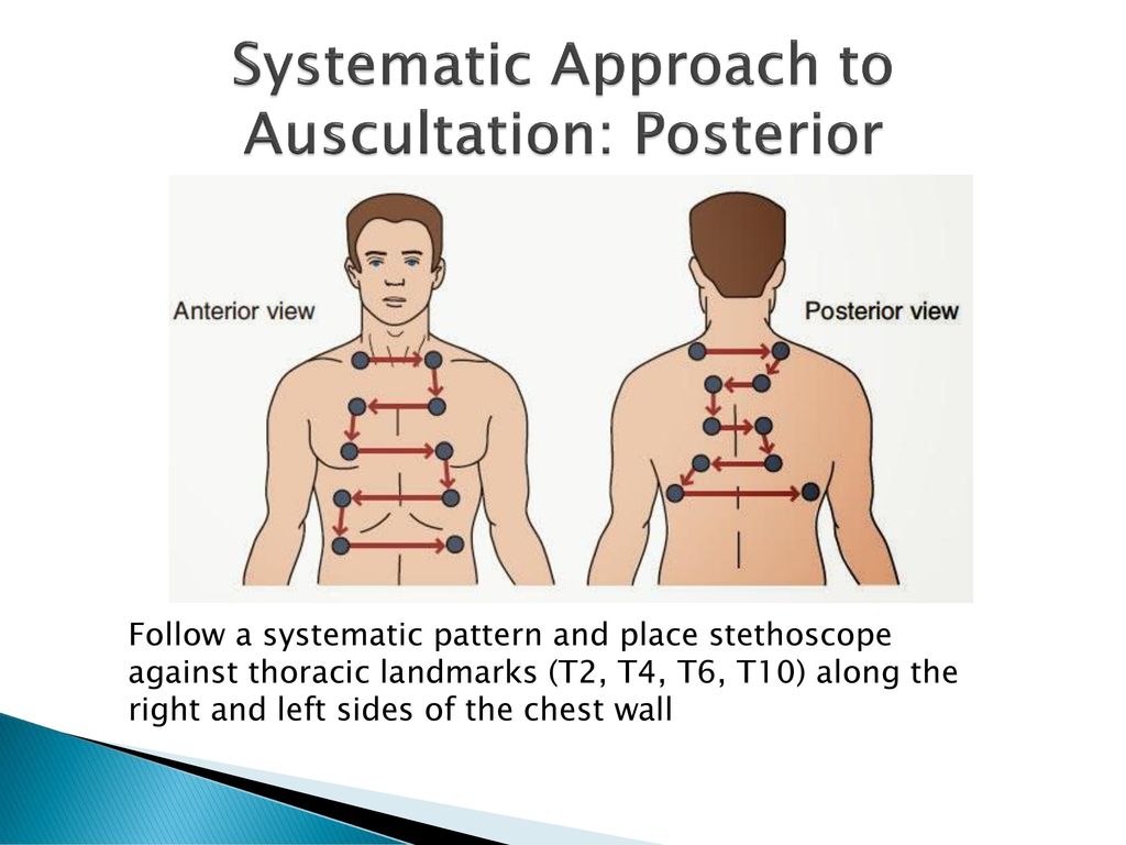 Where To Auscultate Lung Sounds