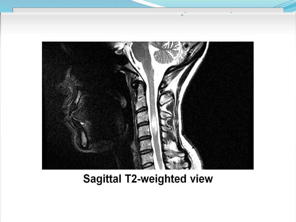 PATIENT PRESENTATION 37 YEAR OLD HOUSE WIFE , Mrs S D