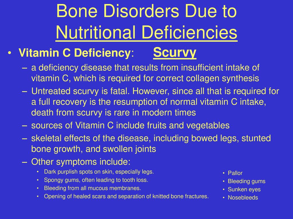 Bone Disorders Due to Nutritional Deficiencies