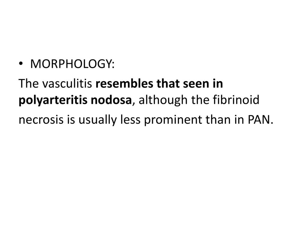 MORPHOLOGY: The vasculitis resembles that seen in polyarteritis nodosa, although the fibrinoid.