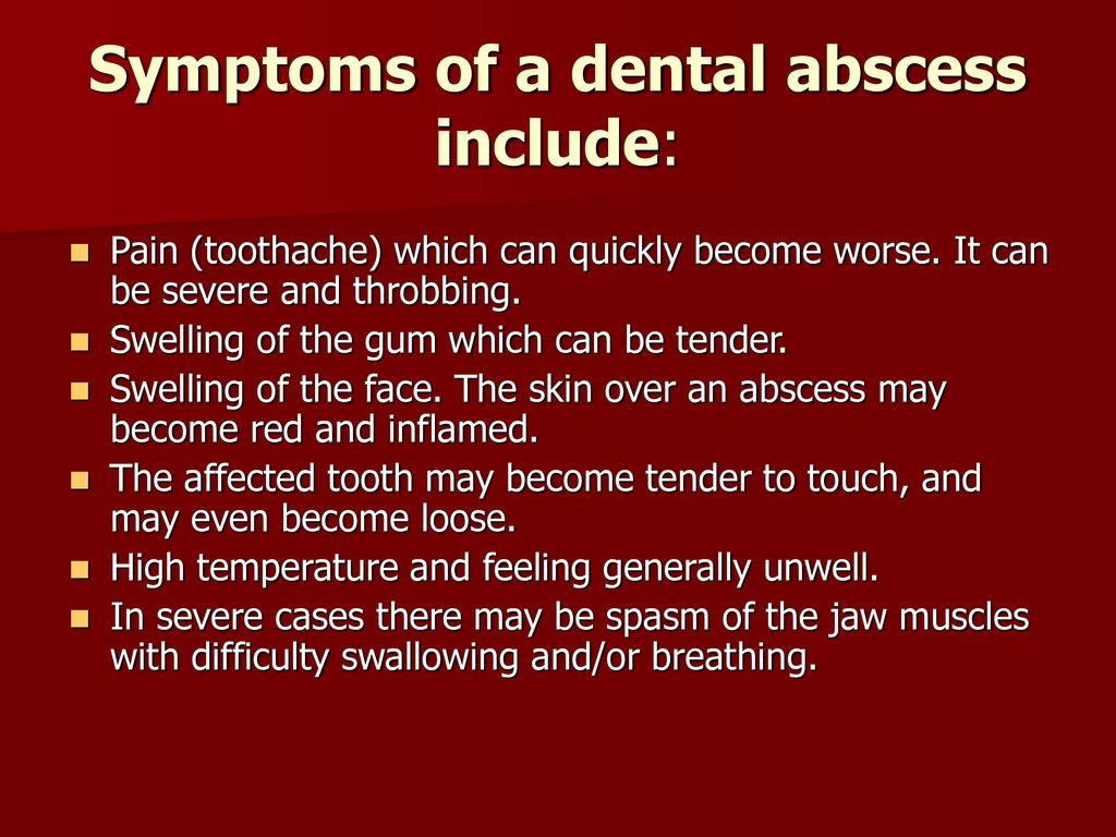 Symptoms of a dental abscess include: