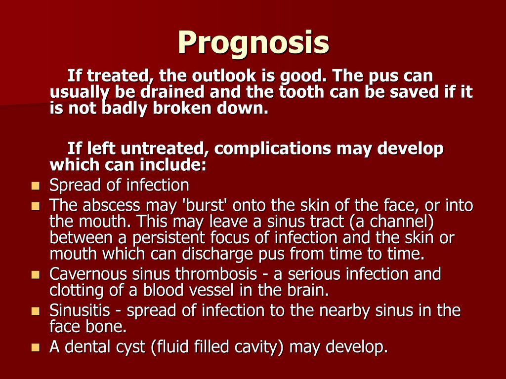 Prognosis If treated, the outlook is good. The pus can usually be drained and the tooth can be saved if it is not badly broken down.