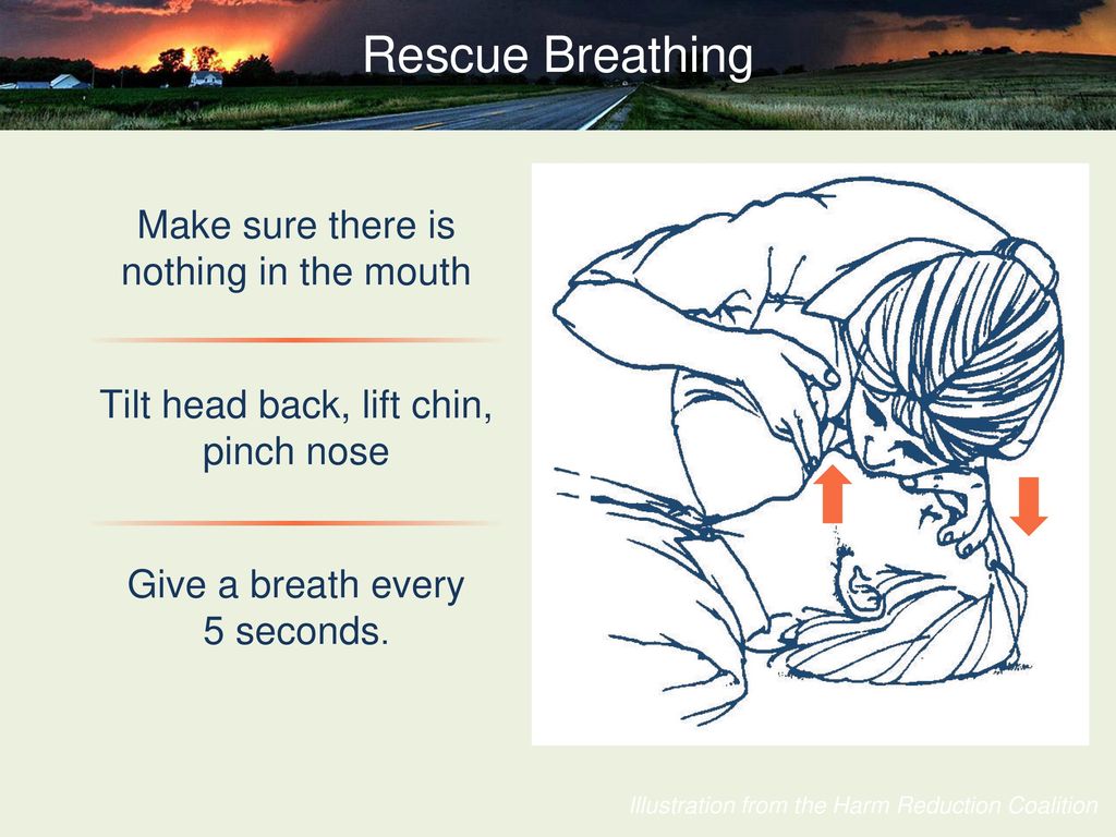 Rescue Breathing Make sure there is nothing in the mouth