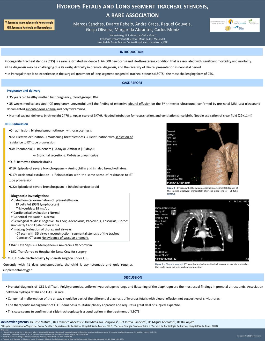 Hydrops fetalis and long segment tracheal stenosis ppt download