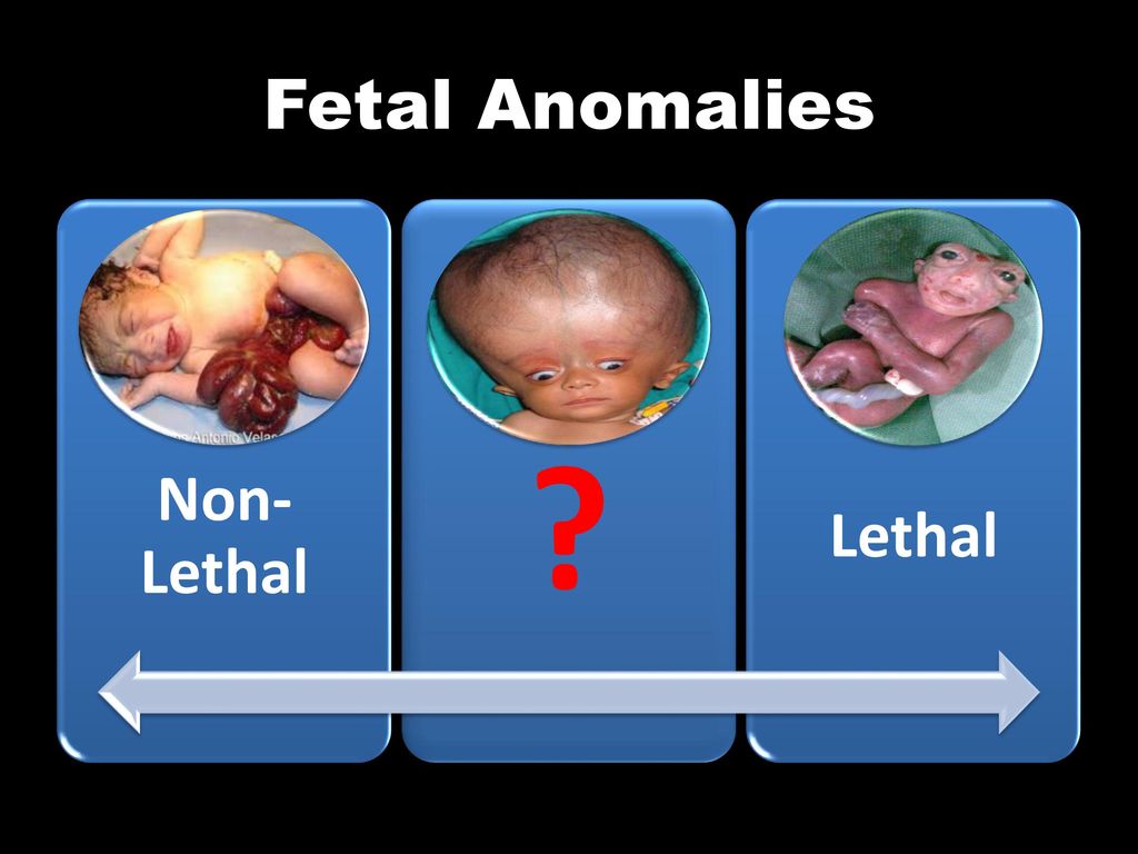 Fetal+Anomalies+Non-Lethal+Lethal.jpg
