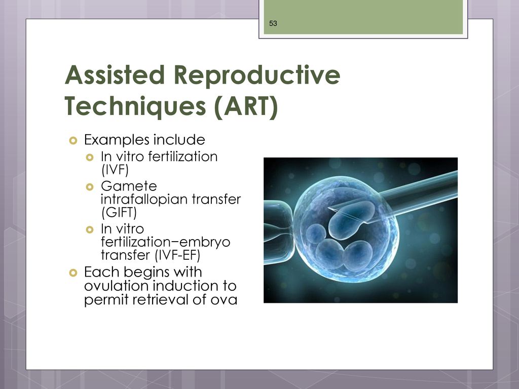 PPT - Assisted Reproductive Technology (ART) Market to grow at 4.4% CAGR  from 2016 to 2023 PowerPoint Presentation - ID:7571100