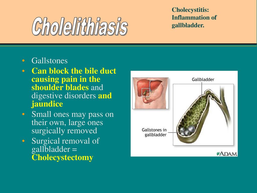 Digestive System Disorders - ppt download