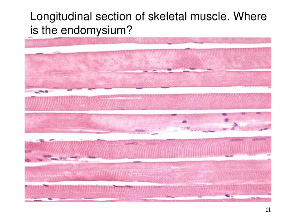 Skeletal Muscle Histology - ppt video online download