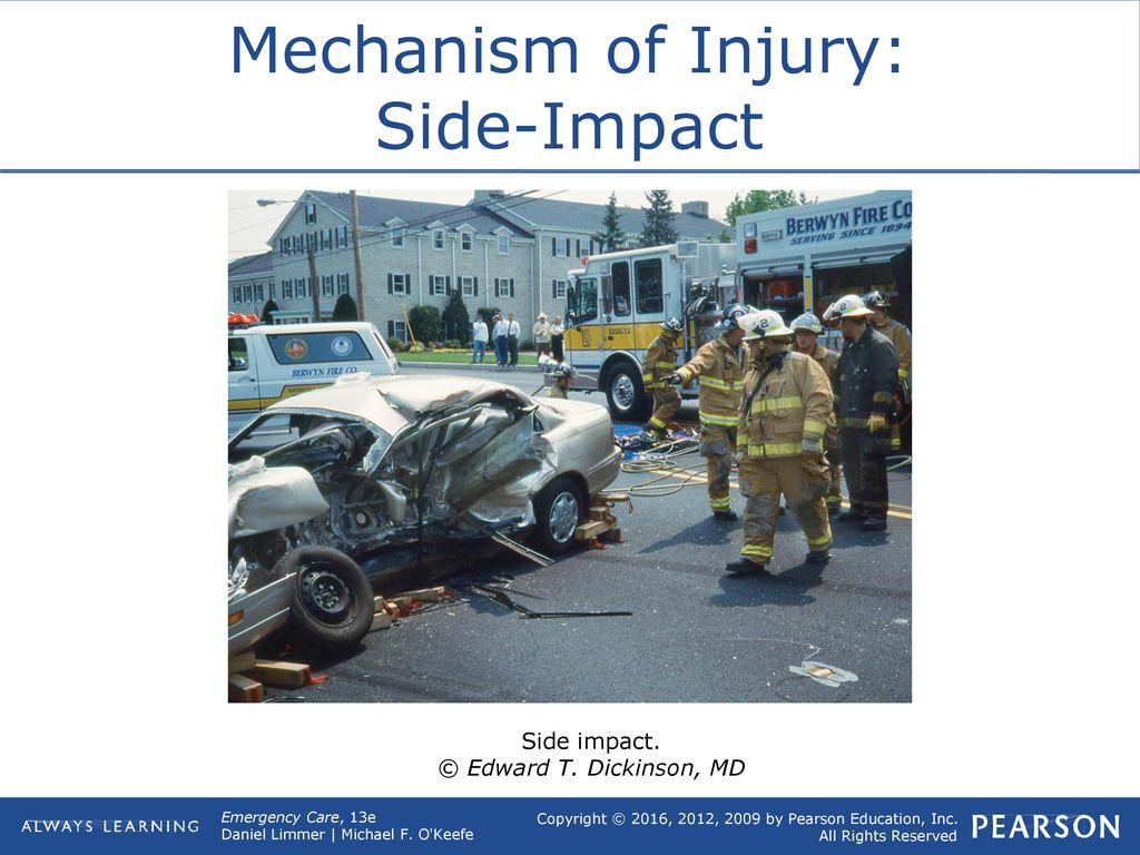 Mechanism of Injury: Side-Impact