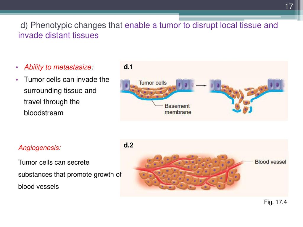 d) Phenotypic changes that enable a tumor to disrupt local tissue and invade distant tissues