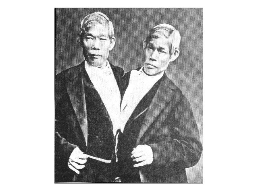 Сиамские близнецы чанг и энг