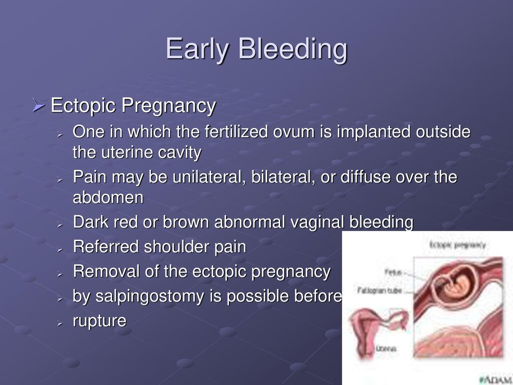 Antepartal Hemorrhagic Disorders - Ppt Download