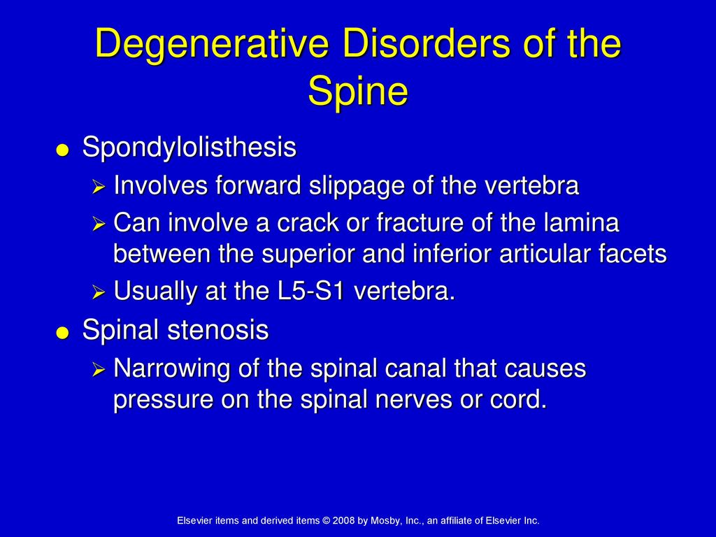 Degenerative Disorders of the Spine