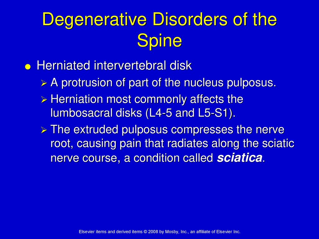 Degenerative Disorders of the Spine