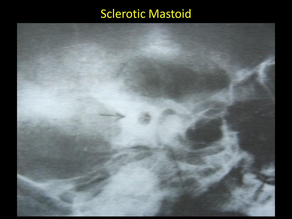 Dr Sujan Chhetri Ms Ent Ppt Video Online Download