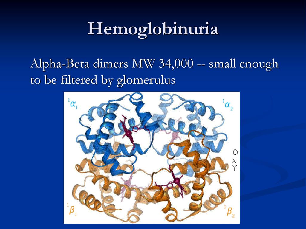Hemoglobinuria Alpha-Beta dimers MW 34, small enough to be filtered by glomerulus
