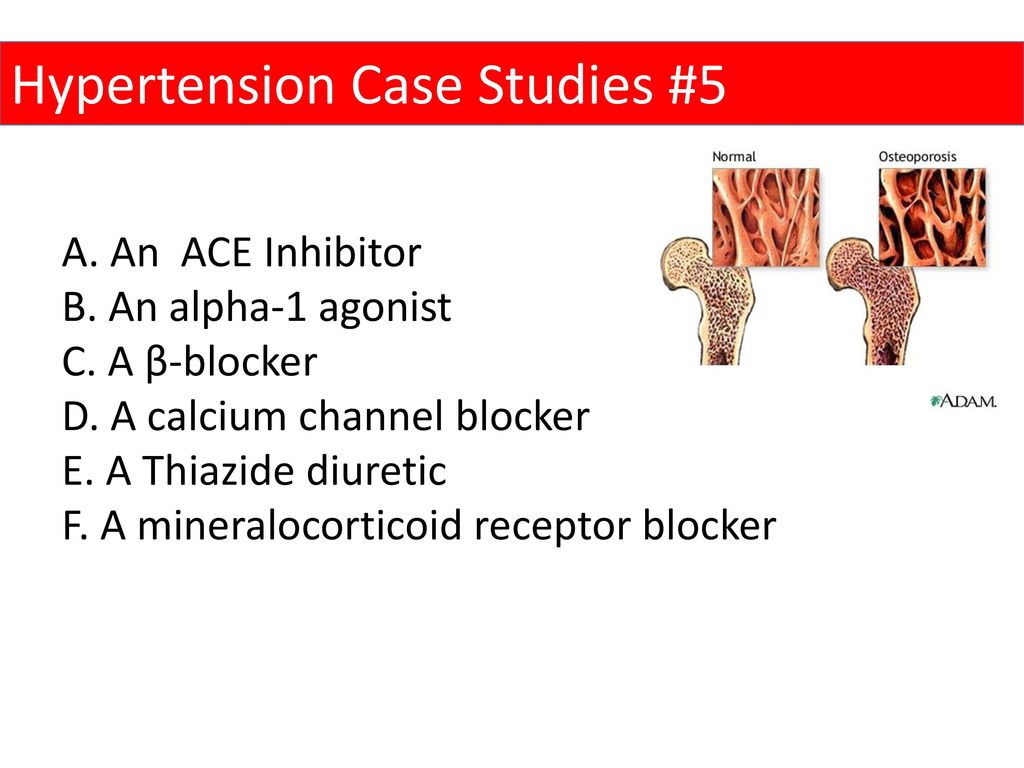 Hypertension Case Studies #5