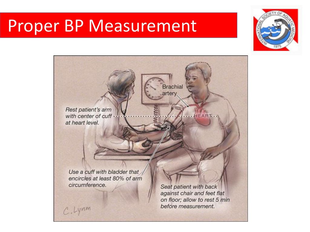 Proper BP Measurement Each 6 inch difference in height between the center of the cuff and heart will change the BP by 10 mm Hg.