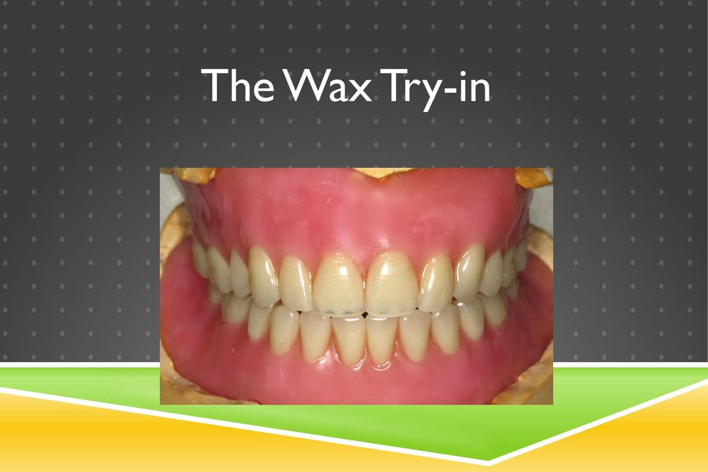 “wax rim denture”的图片搜索结果