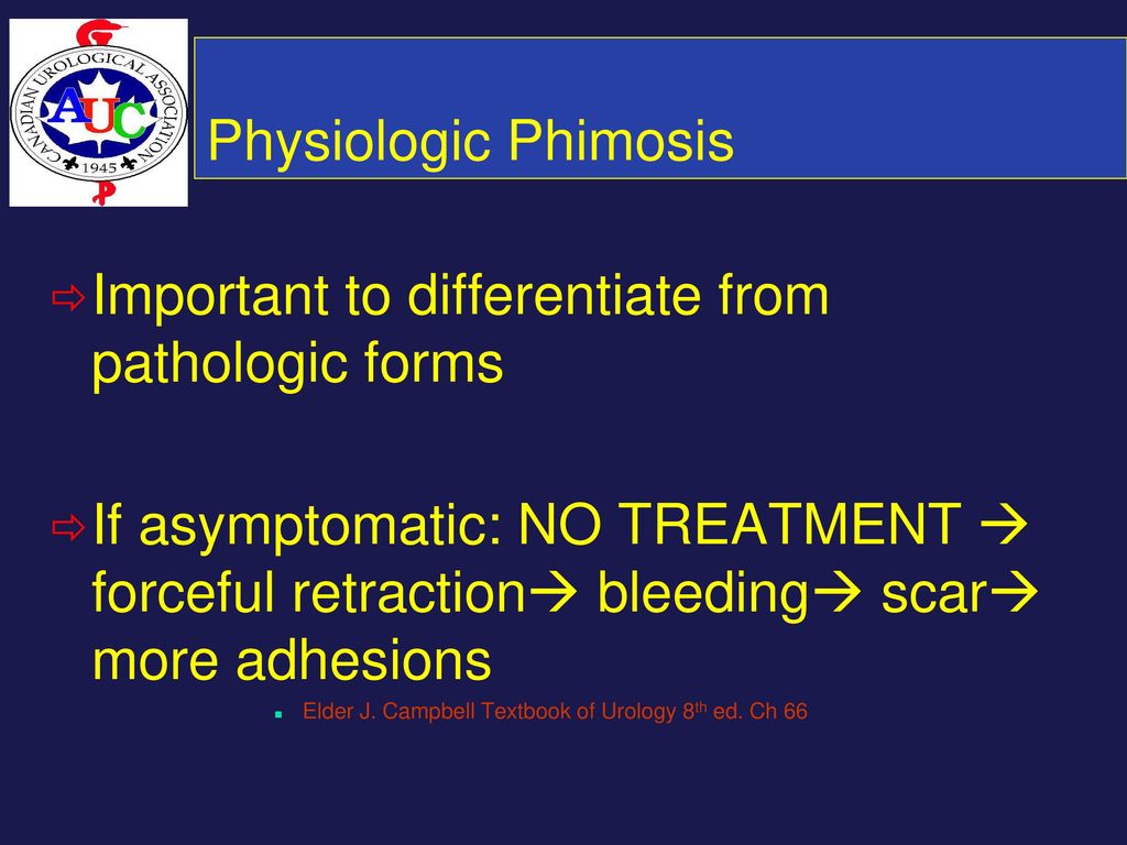Pathologic and physiologic phimosis