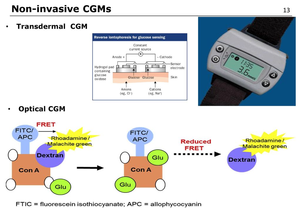 Non-invasive CGMs 13 Transdermal CGM Optical CGM