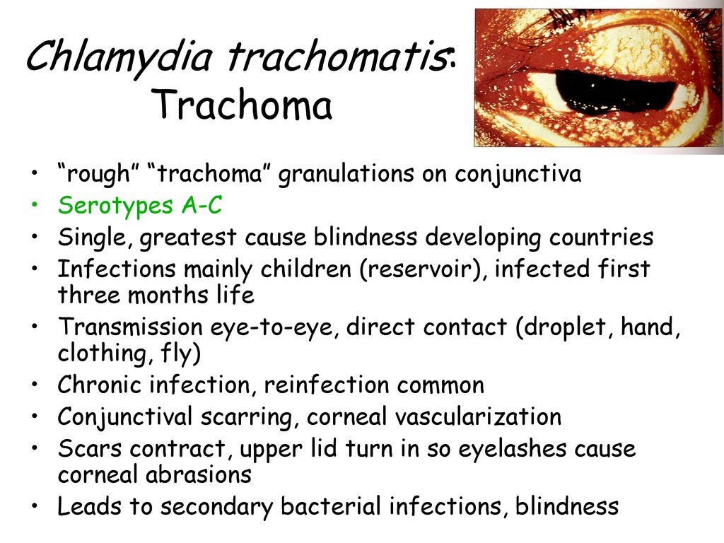 Хламидия trachomatis. Chlamydia trachomatis характеристика. Хламидия трахоматис описание. Хламидиоз трахоматис конкретные факты.